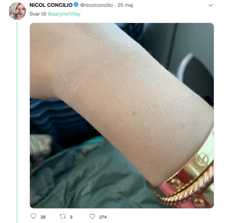 Twitter leverfläck Twitter leverfläck